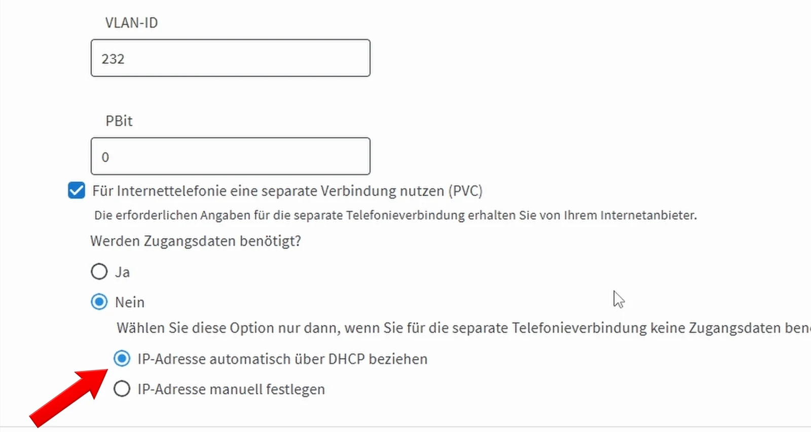Telefonie-VLAN 232 mit PBit 0 separater Verbindung ohne Zugangsdaten und automatischem DHCP